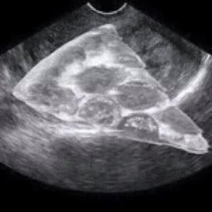 Miscarriage the path that picked me - pregnant with pizza