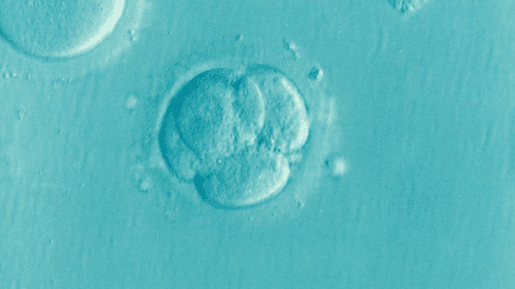 My infertility journey - IVF resulted in many fertilized eggs