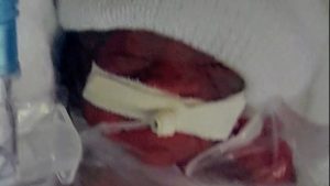 NICU mom
