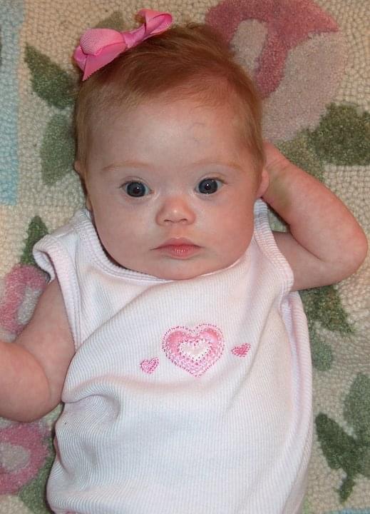 Raising a daughter with Down syndrome - beautiful baby girl