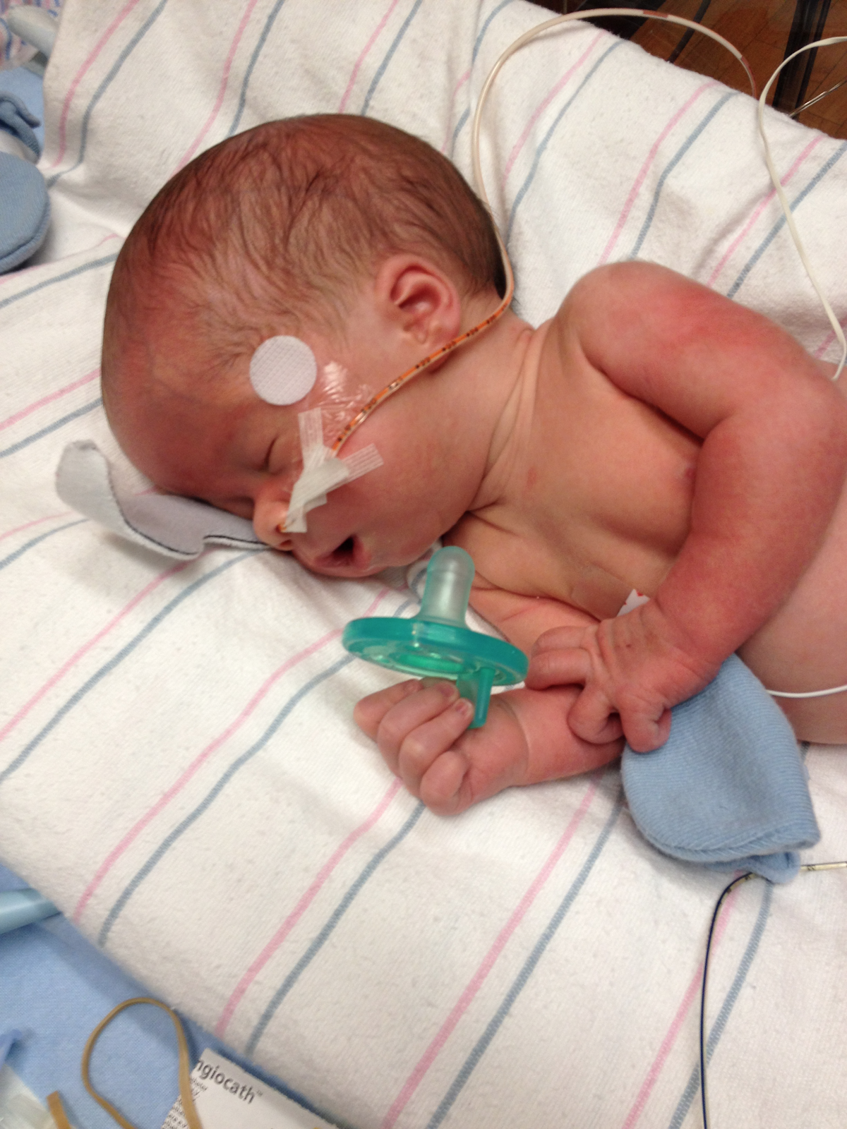 Spina bifida - Andrew was rushed to Children's of Alabama and underwent surgery.