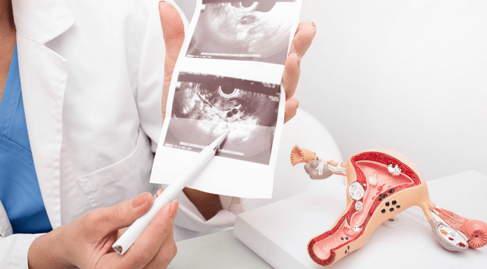 Hysterectomies & Hormones :: UAB Experts Answer Our Most Probing Questions