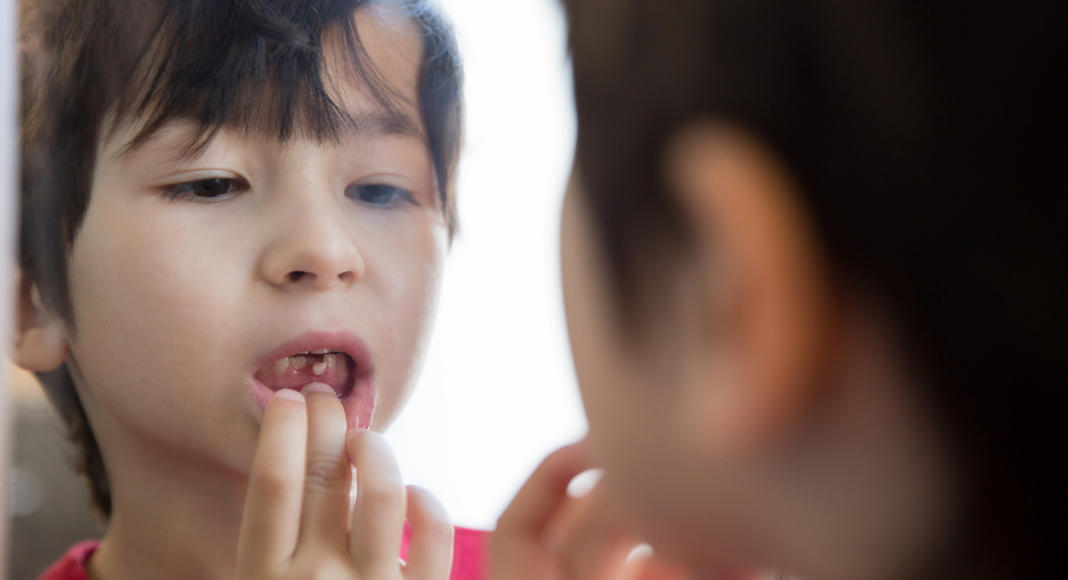 kid with loose tooth