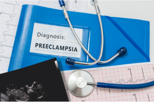 treatments for preeclampsia